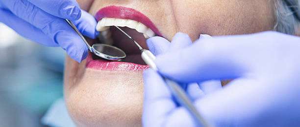 Best Broken or Cracked Tooth Emergency Dentist in Mount Airy, NC